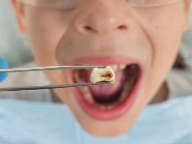 Best Emergency Dentist for Knocked-Out Tooth in East Providence, RI